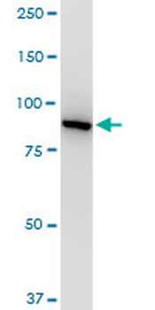 VCP monoclonal antibody (M03), clone 4A8