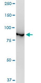 VCP monoclonal antibody (M03), clone 4A8
