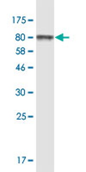 VCP monoclonal antibody (M03), clone 4A8