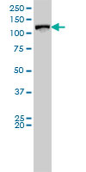 VCL monoclonal antibody (M01), clone 2C6-1B5
