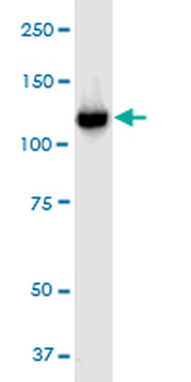 VCL monoclonal antibody (M01), clone 2C6-1B5