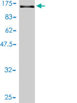 VCL monoclonal antibody (M01), clone 2C6-1B5