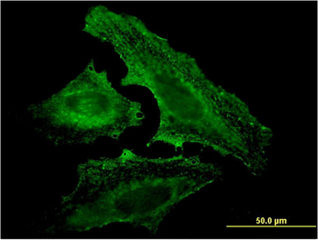UVRAG monoclonal antibody (M04), clone 2E8
