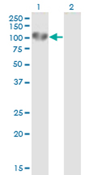 UVRAG monoclonal antibody (M04), clone 2E8