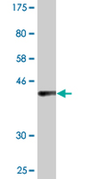 UVRAG monoclonal antibody (M04), clone 2E8