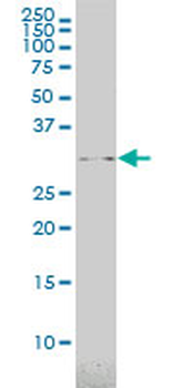 USF1 monoclonal antibody (M01), clone 3F6
