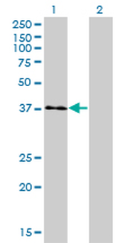 USF1 monoclonal antibody (M01), clone 3F6