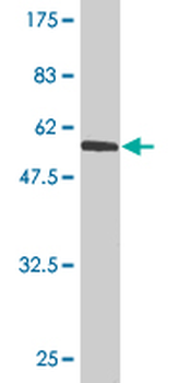 USF1 monoclonal antibody (M01), clone 3F6