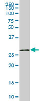 UNG purified MaxPab mouse polyclonal antibody (B01P)
