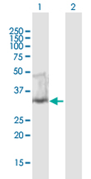 UNG purified MaxPab mouse polyclonal antibody (B01P)
