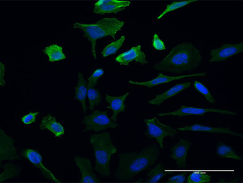 UMPS monoclonal antibody (M06), clone 2B10