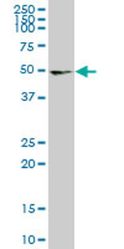 UMPS monoclonal antibody (M06), clone 2B10