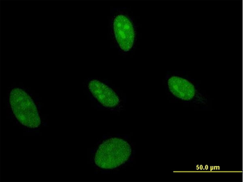 UMPS monoclonal antibody (M05), clone 2F5