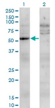 UMPS monoclonal antibody (M05), clone 2F5