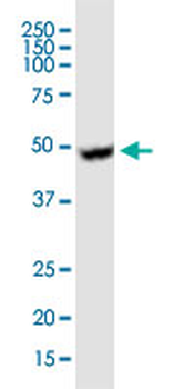UGCG monoclonal antibody (M03), clone 1E5