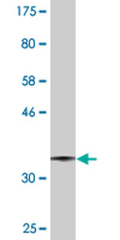 UGCG monoclonal antibody (M03), clone 1E5