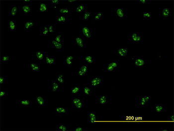 UBTF monoclonal antibody (M01), clone 6B6