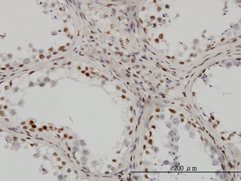 UBTF monoclonal antibody (M01), clone 6B6
