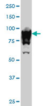 UBTF monoclonal antibody (M01), clone 6B6