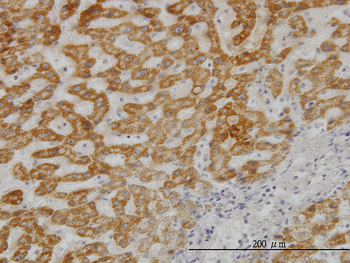 UBE2G2 monoclonal antibody (M01), clone 5E1