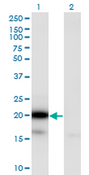 UBE2G2 monoclonal antibody (M01), clone 5E1
