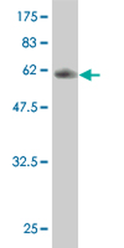 UBE2G2 monoclonal antibody (M01), clone 5E1