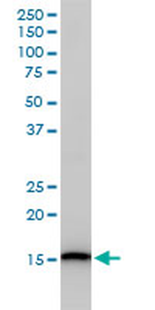 UBE2D3 monoclonal antibody (M01), clone 4C1-1E3