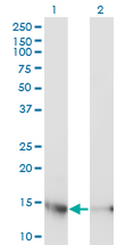 UBE2D3 monoclonal antibody (M01), clone 4C1-1E3