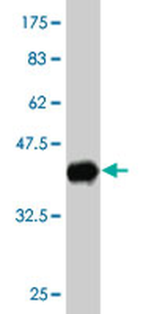 UBE2D3 monoclonal antibody (M01), clone 4C1-1E3