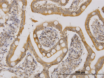 UBE2D2 monoclonal antibody (M02), clone 4A1