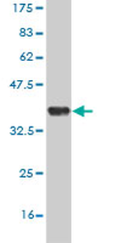 UBE2D2 monoclonal antibody (M02), clone 4A1