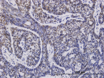 UBE2D1 monoclonal antibody (M01), clone 2C6