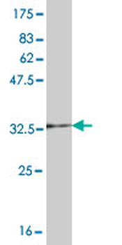 UBE2D1 monoclonal antibody (M01), clone 2C6