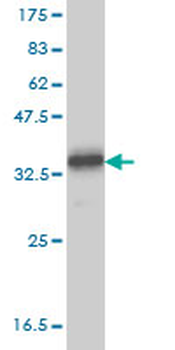 TYRO3 monoclonal antibody (M05), clone 4F6