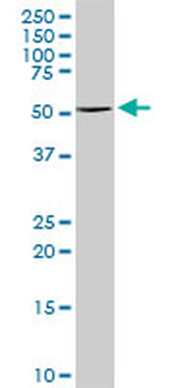 TYR MaxPab rabbit polyclonal antibody (D01)