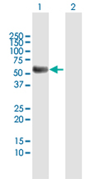 TYR MaxPab rabbit polyclonal antibody (D01)
