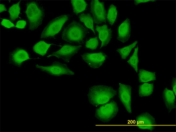 TXN monoclonal antibody (M01), clone 2A7
