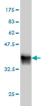 TXN monoclonal antibody (M01), clone 2A7