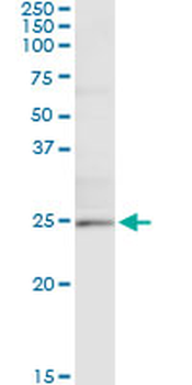 TWIST1 monoclonal antibody (M13), clone 2G12