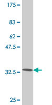 TWIST1 monoclonal antibody (M13), clone 2G12