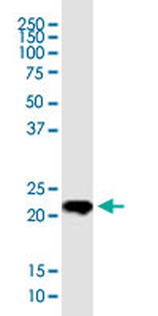 TWIST1 monoclonal antibody (M01), clone 3E11
