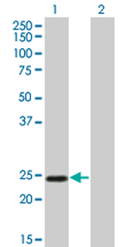 TWIST1 monoclonal antibody (M01), clone 3E11