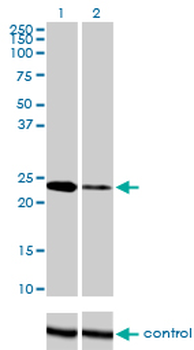 TWIST1 monoclonal antibody (M01), clone 3E11