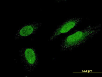 TTN monoclonal antibody (M09), clone 6H5