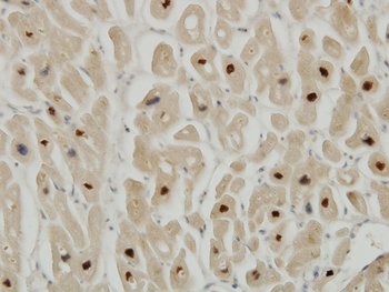 TTN monoclonal antibody (M09), clone 6H5