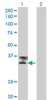 TTN monoclonal antibody (M09), clone 6H5
