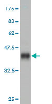 TTN monoclonal antibody (M09), clone 6H5
