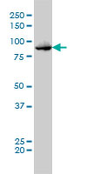 TTK monoclonal antibody (M01), clone 3G7