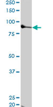 TTK monoclonal antibody (M01), clone 3G7