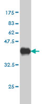 PHLDA2 monoclonal antibody (M01), clone 5E3